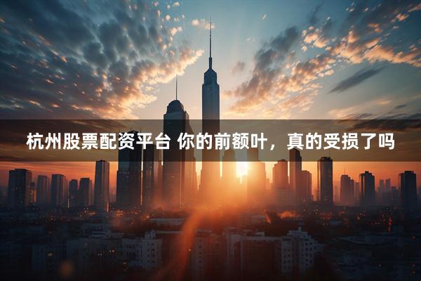 杭州股票配资平台 你的前额叶，真的受损了吗